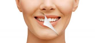 Smile Makeover in Mayur Vihar by A&M dental station